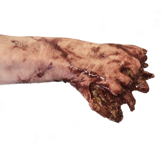 Symulatory ran — zdjęcie